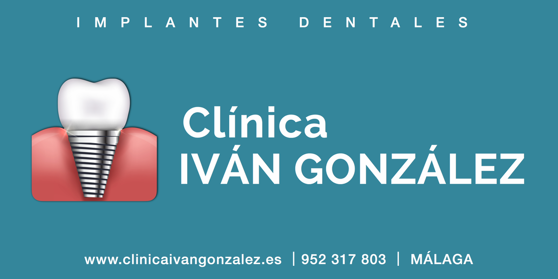 Implantes dentales en Málaga Clínica dental Iván González.